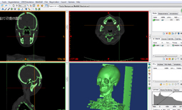 医学3D建模